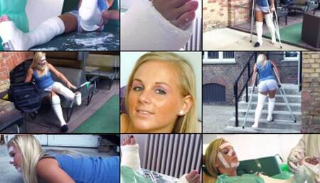 Lilliana LLC, SLWC, LAC with Thumb SPICA Accident Prone Crutching and Application (in HD 1920X1080)