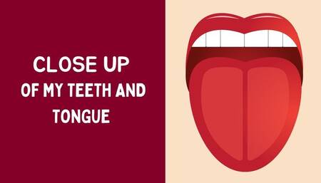 CLOSE UP OF MY TEETH AND TONGUE