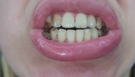Close-up from my mouth chewing