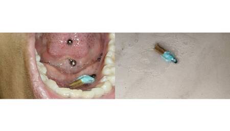 tiny man caught swimming in spit