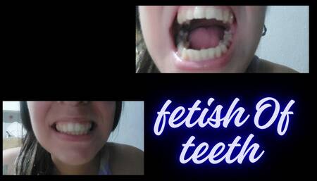 Dientes imperfectos!!