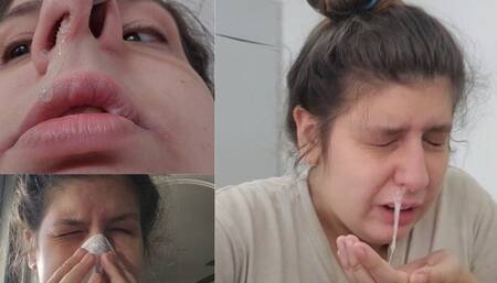 So Sick and Sneezy: Overflowing Mucus, Allergy Fits, and Endless Sneezes