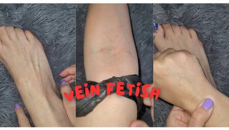 I am so white that my veins are very noticeable