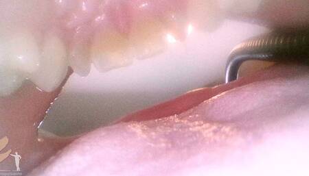 Remedy - Mouth Cam - 1080