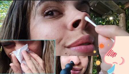 My nose is full of snot