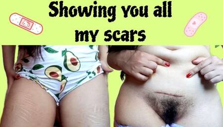 Showing you all my scars