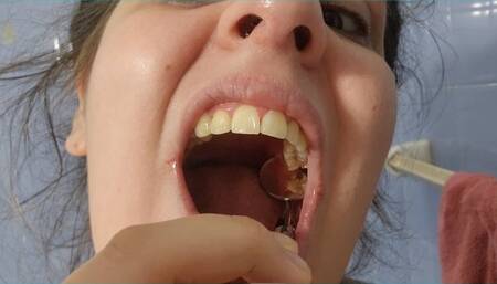 Exploring My Cavities in Extreme Close-Up - Deep Mouth View
