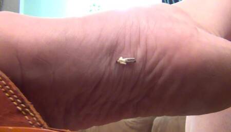 Adventures On Jills Wrinkled Soles