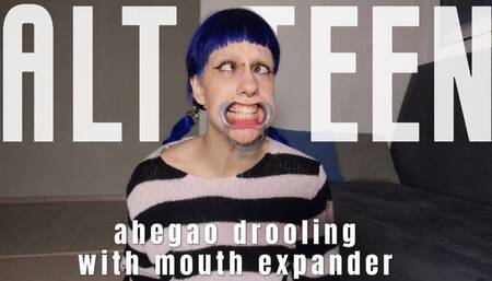 Alt girl's ahegao & drooling with mouth expander