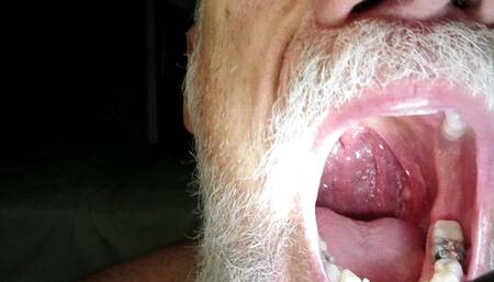 A Tour of My Mouth, Focus on the Uvula