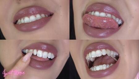 Aligner progress & updates #2 ~ Sweet Maria
