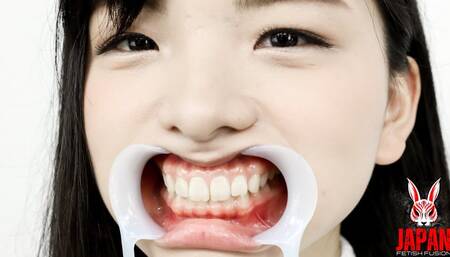 [Teeth Observation] Natural Teeth But Potential Cavities Found!! Beauty Cries When Her Teeth Are Tapped - Suzu Shiratori