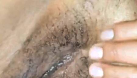 My Hedgehog Is Swollen and Wet