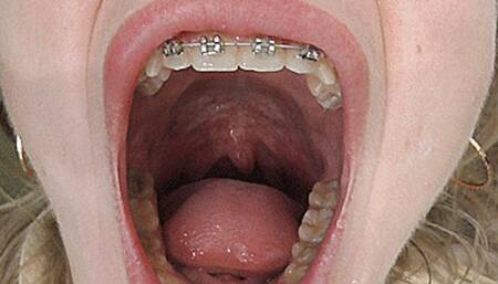 Yawning with a wide mouth and tongue! MP4