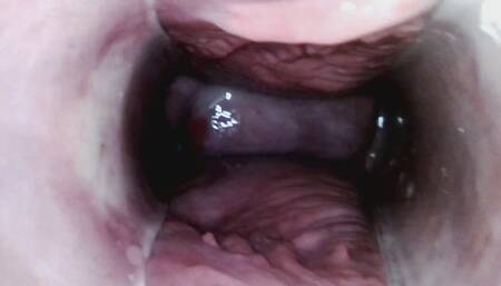 Endoscopy inside my perfect ass