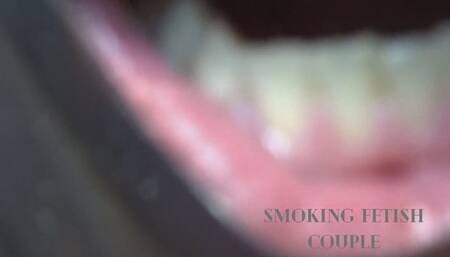 Giovanni's Mouth Interior