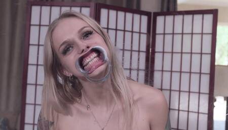 Plexiglass Princess With Ashley Moore Dental Spreader