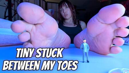 Tiny Stuck Between My Toes