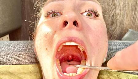 Doctor's Deep Oral Examination POV