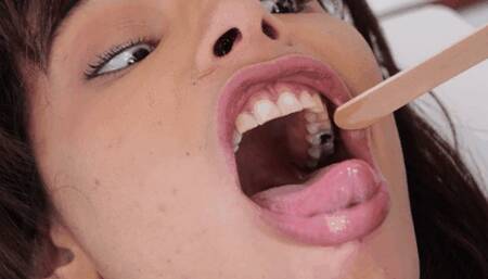 Miss May and her old fillings ( MOUTH FETISH )