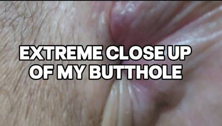 Extreme close Up of my butthole