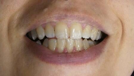 Greasy Chicken Thighs Get Chewed ASMR Sloppy Eating Burping