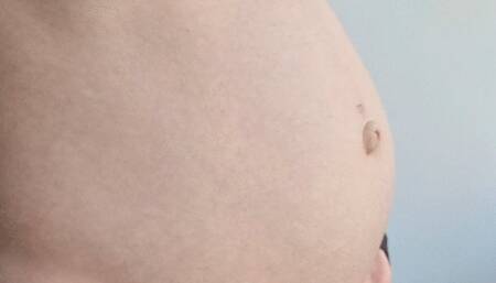 Bloated Belly Standing Up