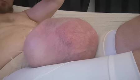 Bulging Again After Extreme Pumping