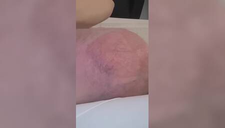 Bulging Again After Extreme Pumping
