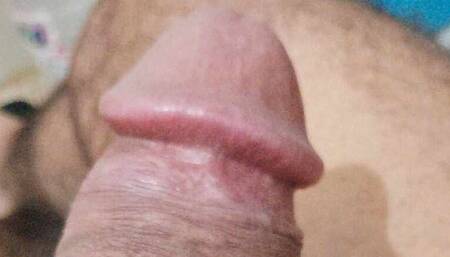 Toda I Am so Hot
