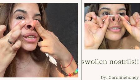 My nose is very swollen