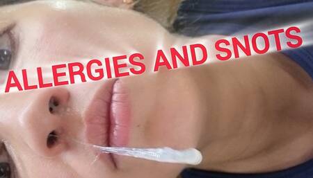 DISGUSTING SNOTS AND ALLERGIES