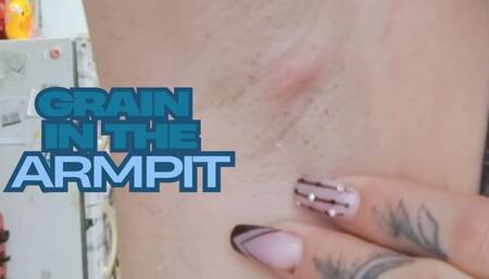 Pimple growing in my armpit
