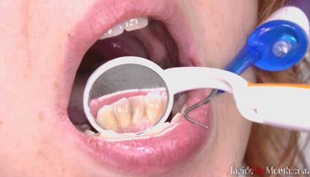 Inside My Mouth - Alex got a mouth exam (4K)