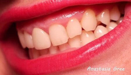 The sharpest and strongest teeth