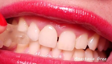 Extremely sharp teeth close-up - Biting jelly